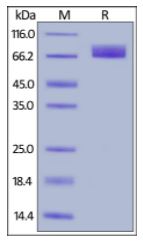 Human PDGF R alpha, His Tag on SDS-PAGE under reducing (R) condition. The gel was stained overnight with Coomassie Blue. The purity of the protein is greater than 95%.